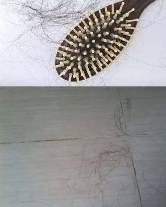 发际线竟然重新长出头发了!快试试这块小黑皂