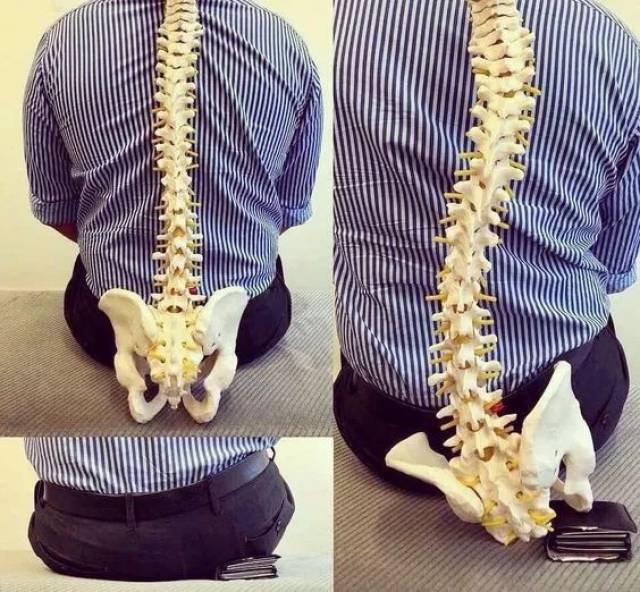 11张身体姿势"脊柱形态"正误对比图,你是对的吗?
