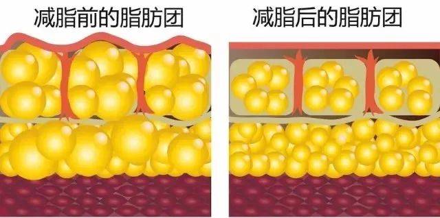 脂肪细胞直径减小