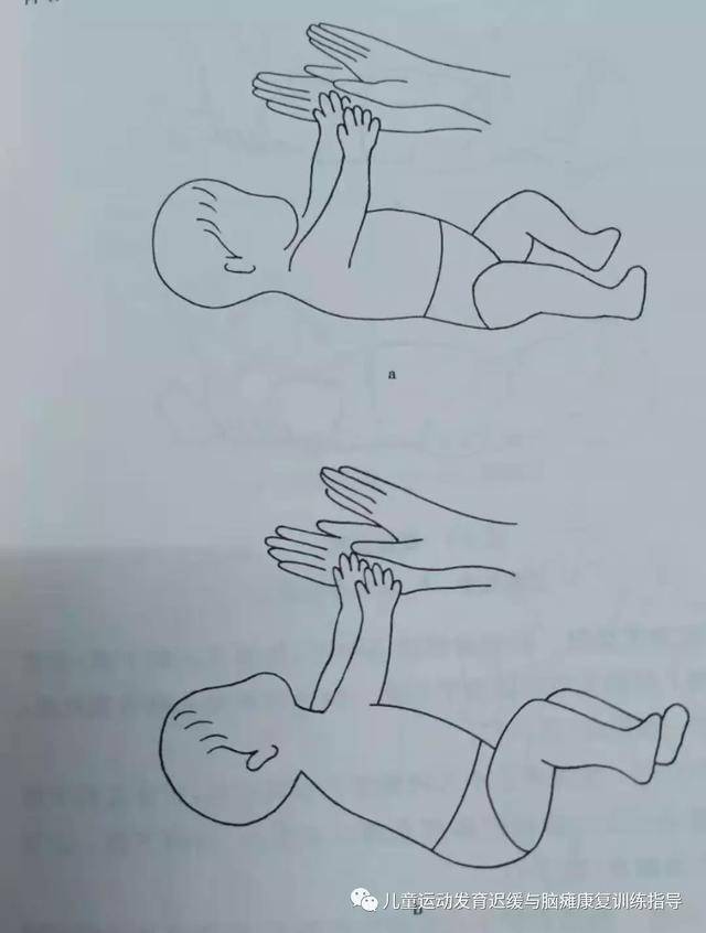 非对称性紧张性颈反射:检查者两手持小儿头部左右回旋头,如为脑性