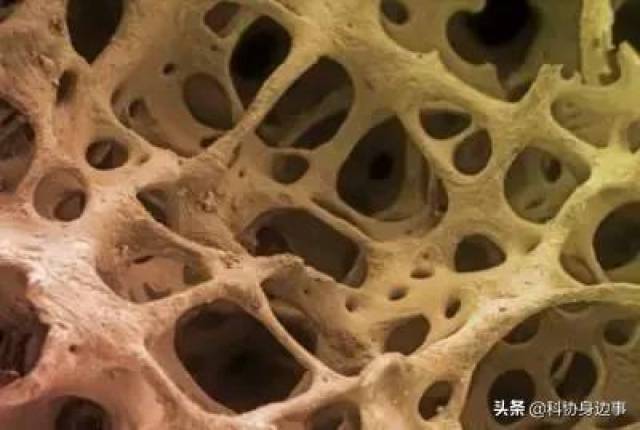 印度研制出促进骨组织生成的新型材料