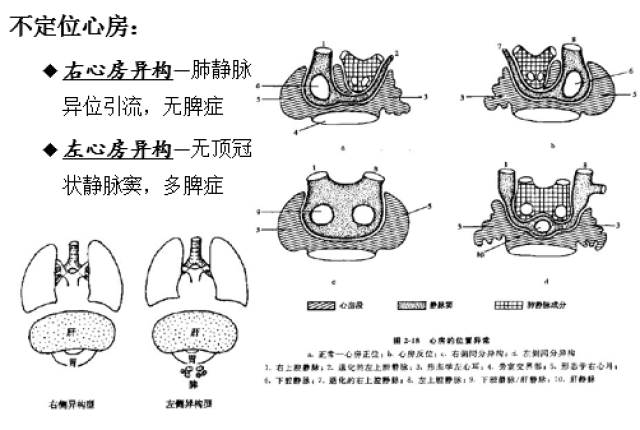 心脏是一个会动的"房子"