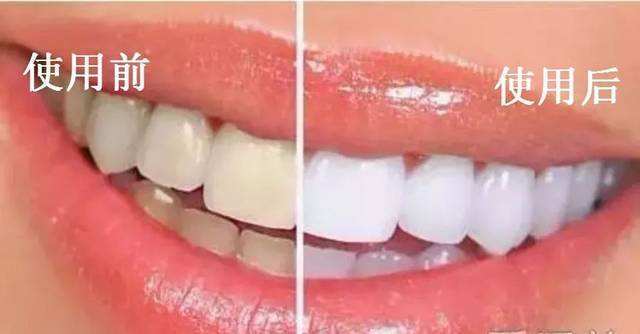 冰瓷美牙培训靠谱吗是不是骗的人_成都篇