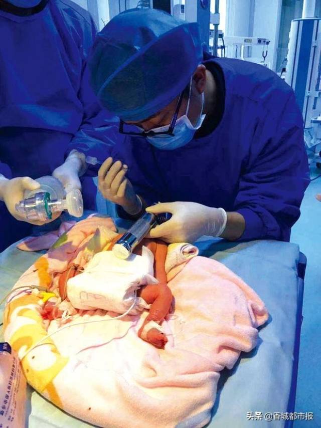 6斤早产儿,因各器官发育不完善,严重危及生命 72小时生命赛跑 "袖珍