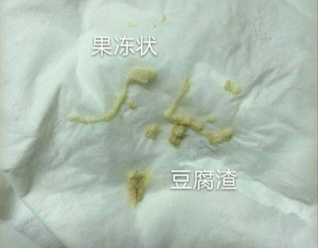 子宫病了,小内内会有黄斑,血丝,豆腐渣状物质,散发醋酸味