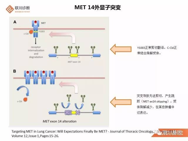 met 14外显子突变和met基因扩增 | 知识分享