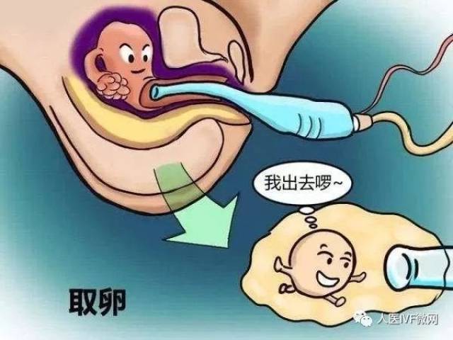 首先,取卵手术是试管婴儿的必经步骤,确实会给患者带来不适感.