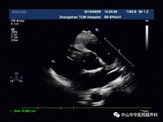 【检查宝典】宝宝出生后有必要做超声心动图检查吗?