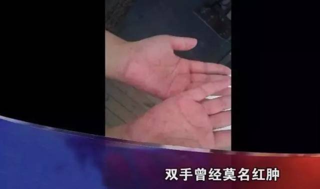 百亿减肥药帝国,和它阴影下的中国女人