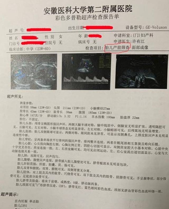产前筛查超声报告单