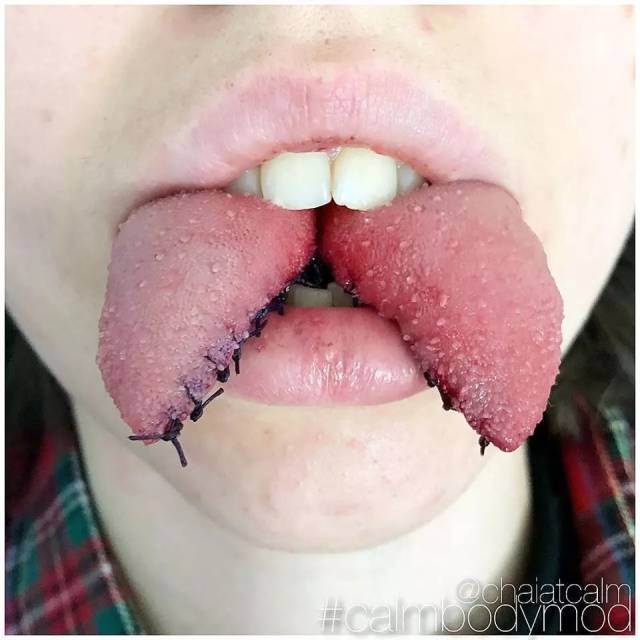 甚至还有把舌头切成两瓣,把人类的舌头打造成蜥蜴舌头的