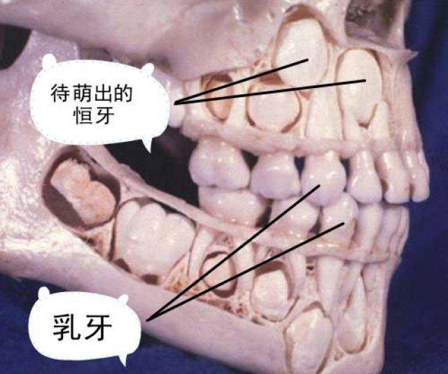 一,儿童换牙时期的头骨:这个阶段「恒牙」未萌出,和「乳牙」同时存在.