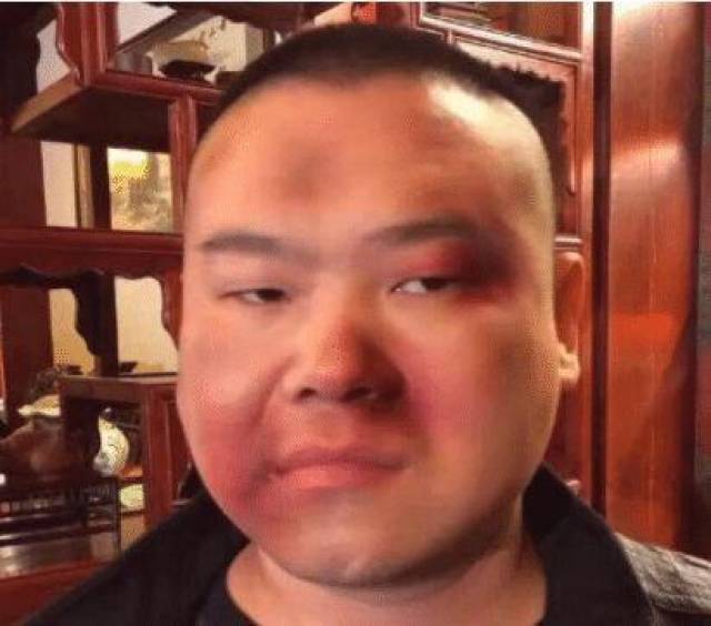 岳云鹏走红膨胀被打,郭德纲找上门气的大骂: 活