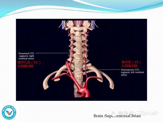 椎-基底动脉系统ct,mr及dsa影像解剖