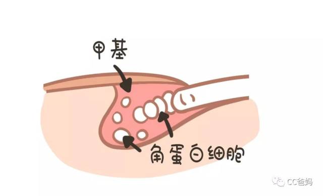 指甲的生长是由甲基(是一个角蛋白细胞的制造基地)不停地制造新的角