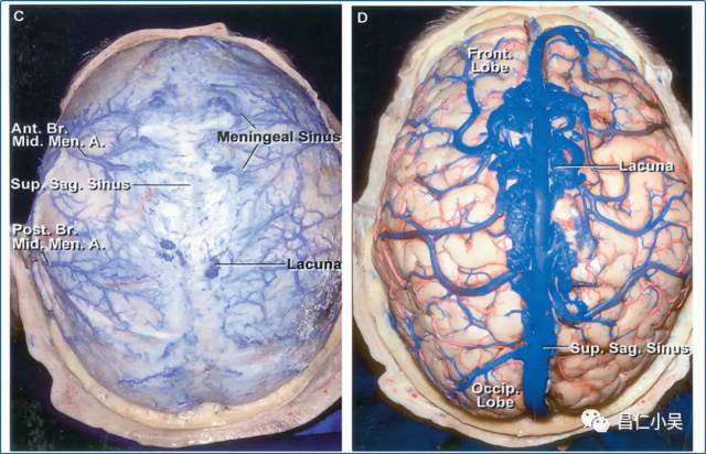 解剖学习笔记 | 脑静脉