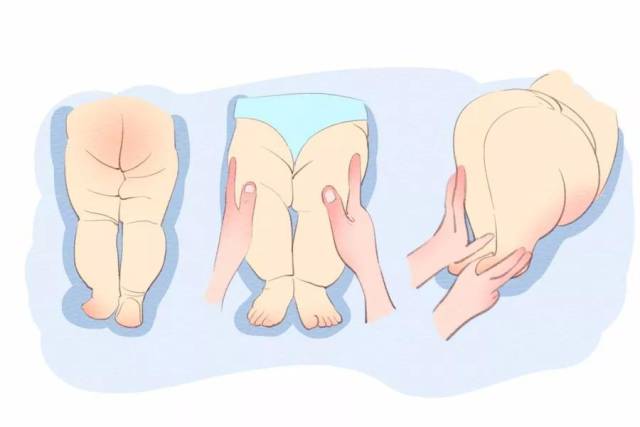 随着患儿年龄增长,体格检查方法不同: 1,小于3个月的新生儿及婴儿:最