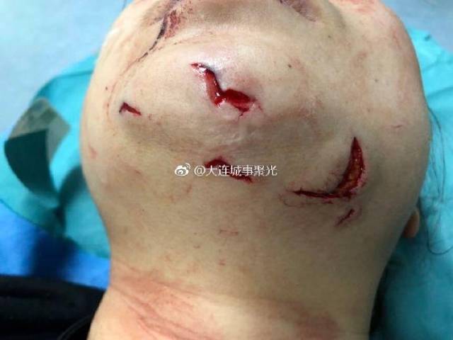 惊悚女子在大连老虎滩极地馆练潜水结果被虎鲨咬住脑袋