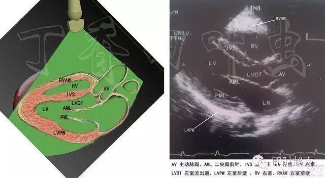 左室长轴切面——心动画