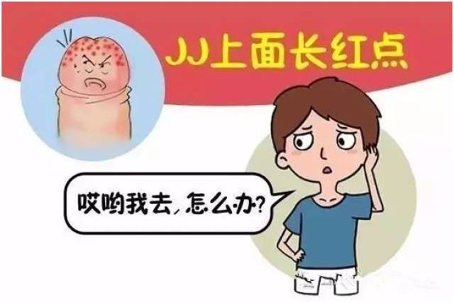 男人龟头上长红斑怎么回事?是x病吗?