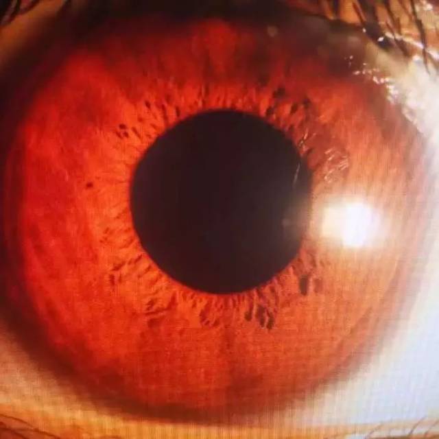 人的瞳孔就像宇宙中的黑洞,就好像一切光源都逃不过你的眼睛一样 妇科