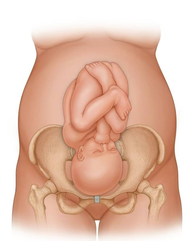 剖腹产不可避免产后松弛,但有方法可助恢复,而且安全成本还低
