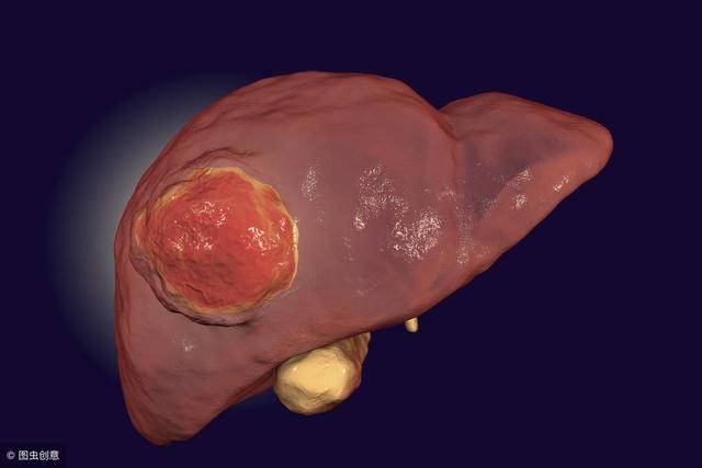 为什么所有的肿瘤,都容易转移到肝脏,肝转移还有救吗?
