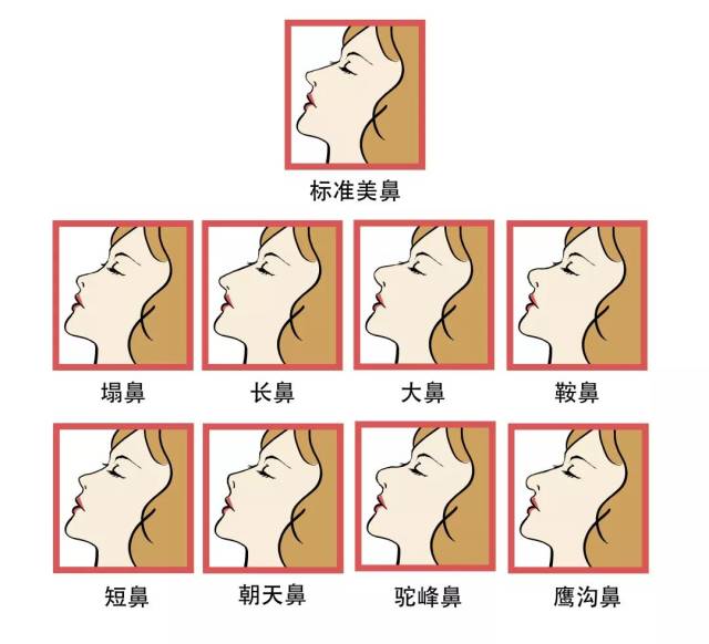 (左:鼻缺损 右:鼻歪) 2 跟标准的鼻子相比,下面这些鼻子只是形态没有