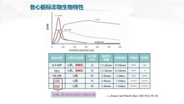 图文详解 | 急性心肌梗死的判读