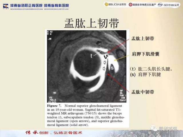 也能较好的显示肩峰及肩峰下滑囊,上下盂唇,三角肌,肱二头肌腱盂唇