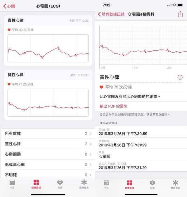 apple watch 心电图功能香港有得用!检测心房颤动透视