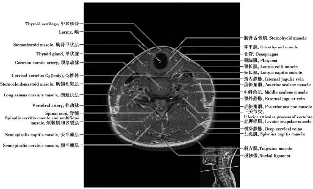 中枢神经系统影像解剖图谱连载2| 颈椎mri概论 t1wi轴位解剖图