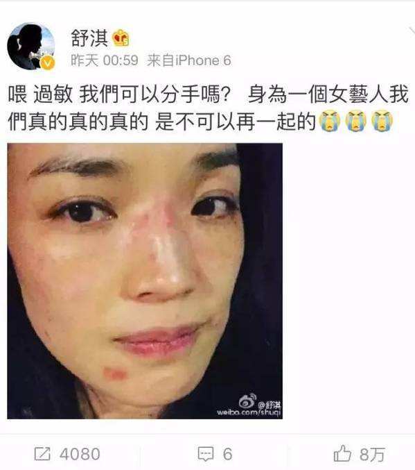 密恐警告!这9个女明星的皮肤真的很差!有人一