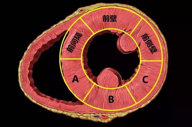 下图为左心室短轴切面的解剖示意图,图中"前壁"前侧壁"前间隔"三个