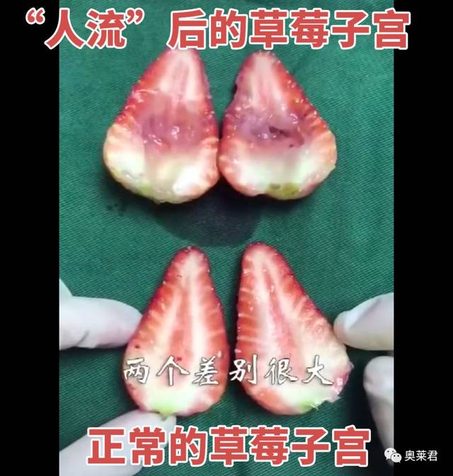 光是看着人流款草莓就觉得疼,这要是做在花季少女的子宫上…想想疼哭