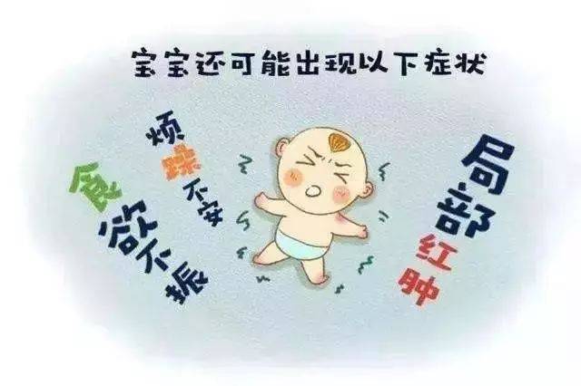 宝宝出生第一针——卡介苗