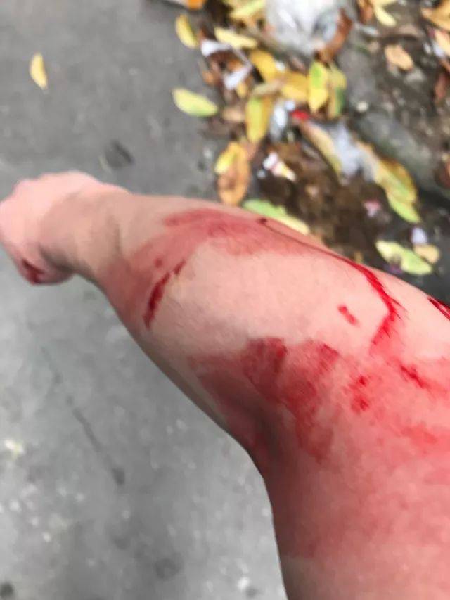 温州一派出所副所长被捅!鲜血直流
