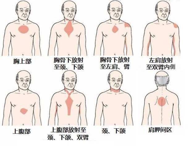 冠心病也有"天敌",常吃这2种蔬菜,让冠心病与你"无缘"