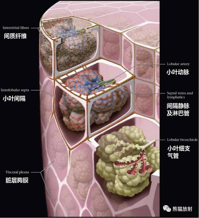 次级肺小叶丨解剖,正常及异常影像