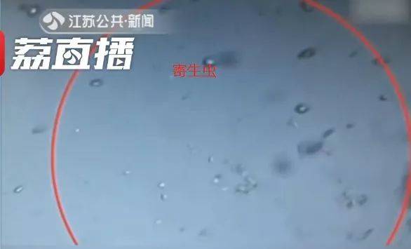 检验中心检验后发现 其中1份小龙虾的头部液体中 存在寄生虫 相关学者