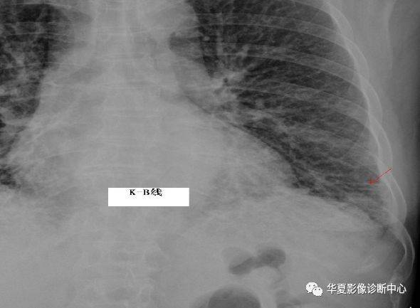 温故知新克氏线kerleylines