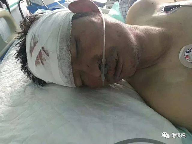 遭遇车祸,由120收治入滑县新区医院重症监护室,头部重伤,现病人深昏迷