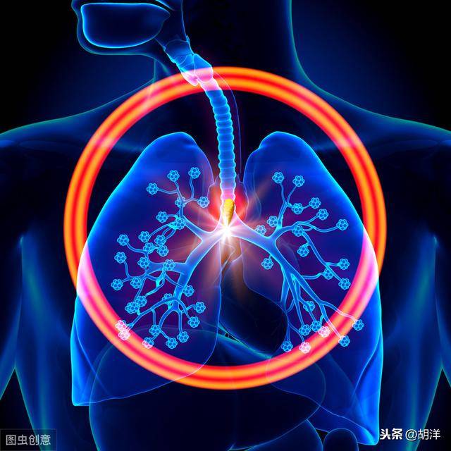 体检发现肺局部纤维灶会演变成肺纤维化吗?有