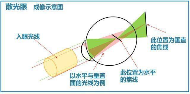 二,散光的原理以及散光的原因