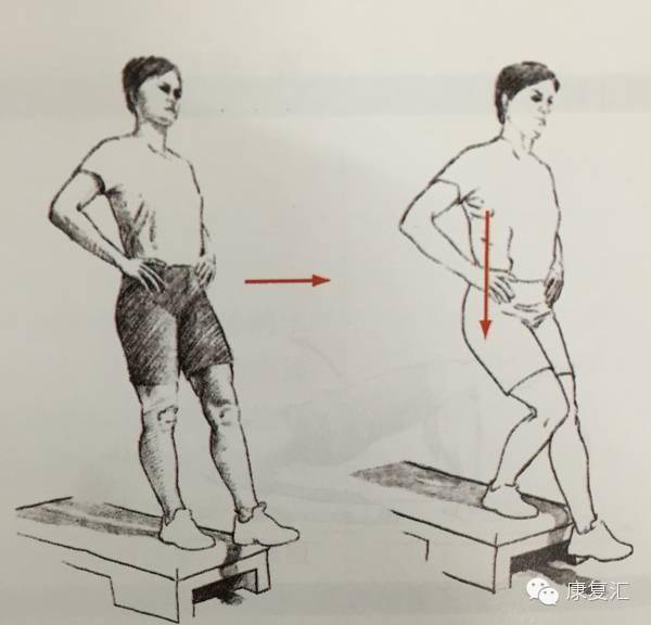 前交叉韧带重建术后康复训练