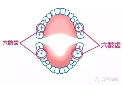 六龄牙终生不换你知道吗