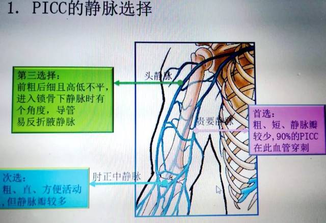 (4)因导管可直接进入上腔静脉,此处血流量大,可迅速降低液体渗透压或