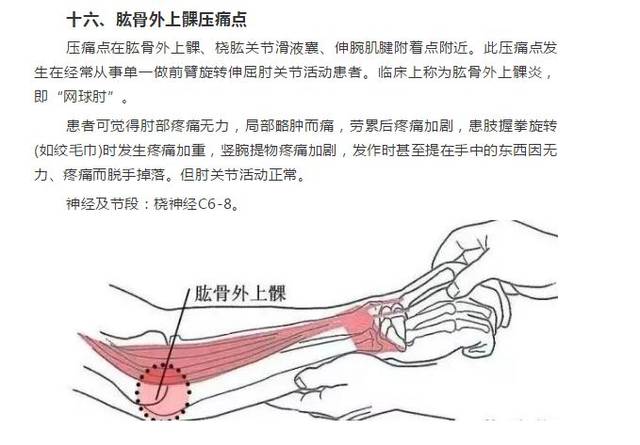 软组织常见压痛点