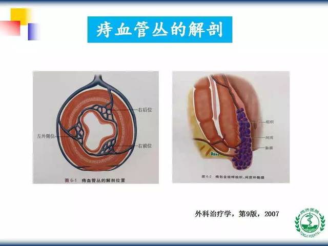 教学ppt内镜下内痔硬化规范化治疗