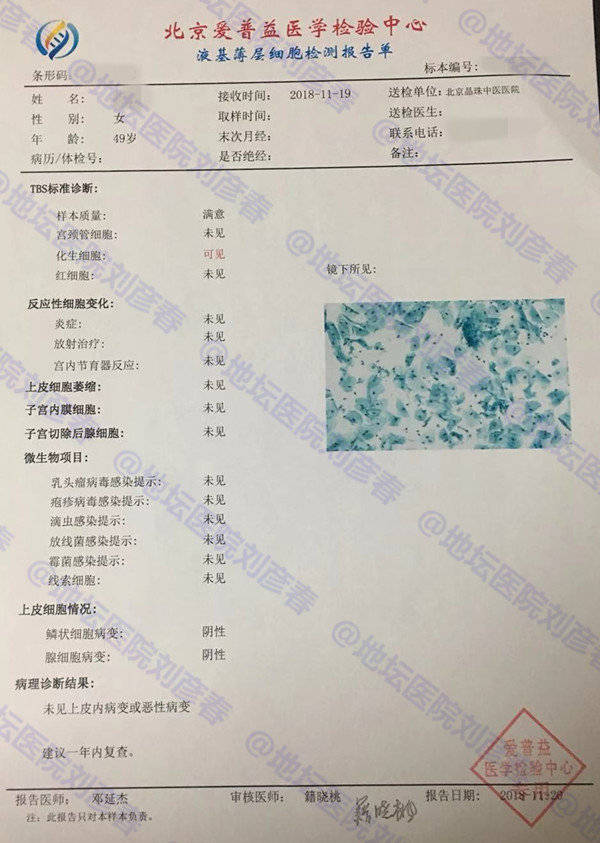 病例分享--宫颈病变cin2级,经4个月治疗后痊愈